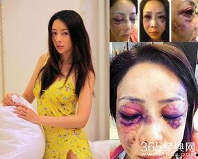 明星家暴事件,明星家暴事件引发社会关注与反思